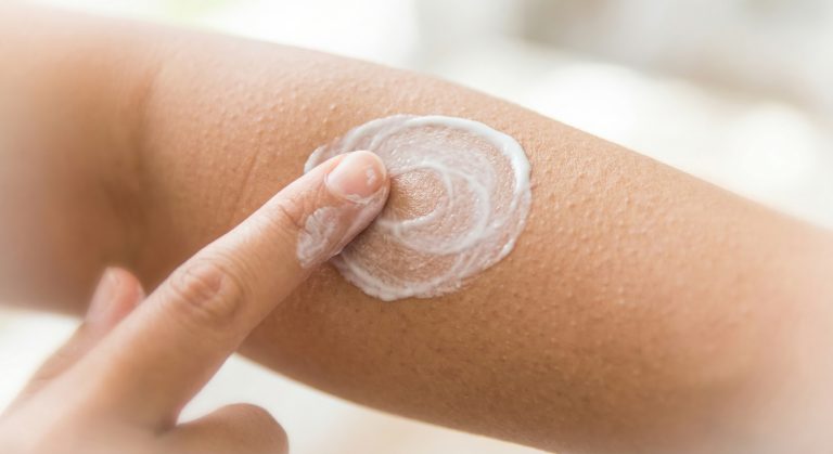 Pessoa aplicando creme hidratante no braço com pequenas bolinhas na pele, características da ceratose pilar