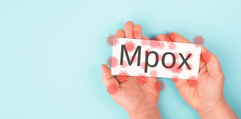 Pessoa segurando um cartão com a palavra “Mpox”, com ilustrações do vírus ao redor, sobre fundo azul.