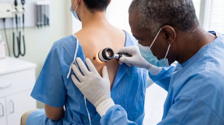 Médico realizando exame dermatológico em pinta nas costas de paciente, ilustrando a avaliação e prevenção do câncer de pele por meio do diagnóstico precoce.