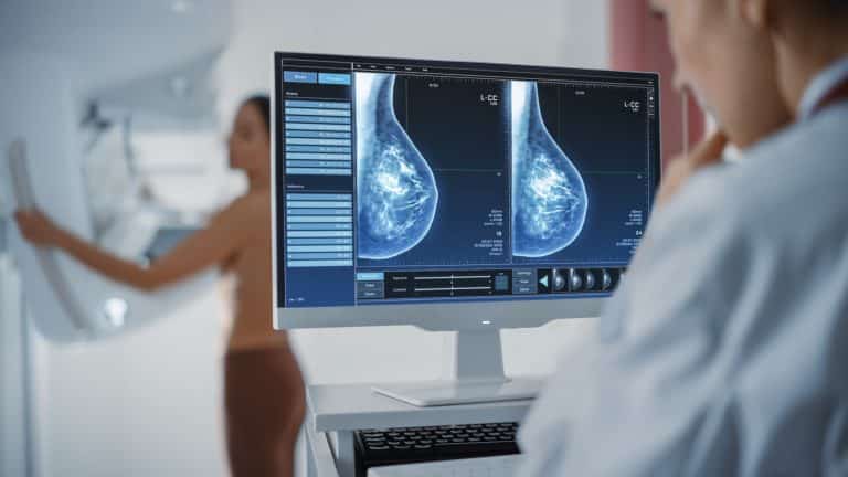 Profissional de saúde analisando imagens das mamas em um monitor enquanto paciente realiza o exame, representando a mamografia de rastreamento para prevenção e diagnóstico precoce do câncer de mama.