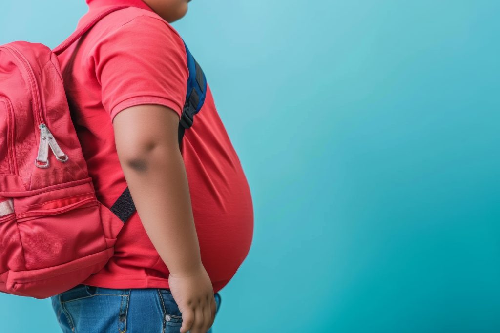 Criança com excesso de peso, ilustrando a obesidade infantil e a importância da identificação precoce dos sinais para proteger a saúde e o desenvolvimento.